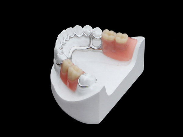 Print metal framework