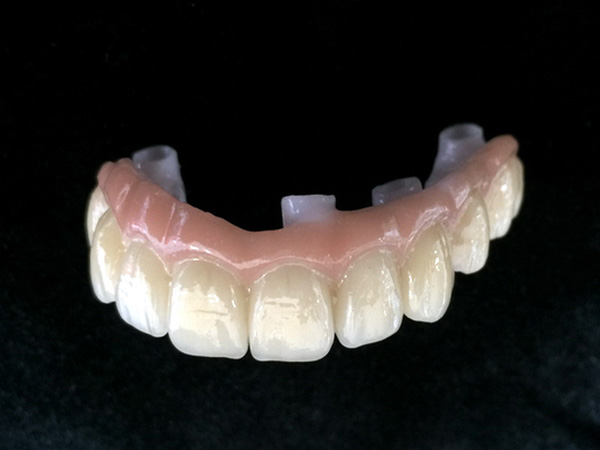 Implant Zirconia
